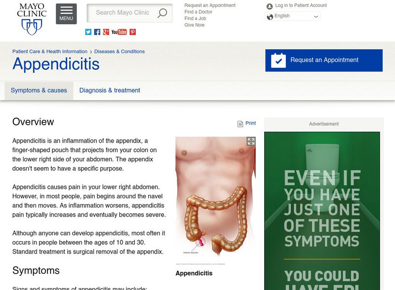Mayo Clinic: Appendicitis Handout Mayo Clinic: Appendicitis Handout