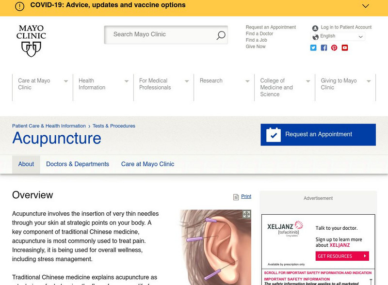 Mayo Clinic: Acupuncture Handout Mayo Clinic: Acupuncture Handout