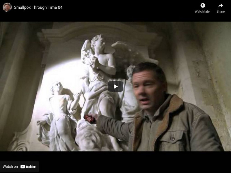 Timelines Tv: Smallpox Through Time 04: Child Pox: 1711 Instructional Video