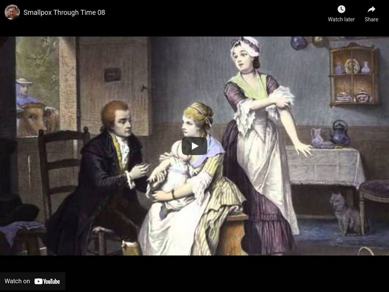 Timelinles Tv: Smallpox Through Time 08: The Vaccine Triumphant: 1797 1812 Instructional Video