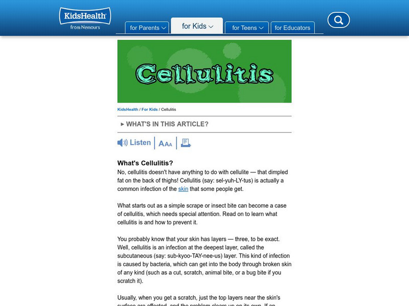 Kids Health: Cellulitis Article