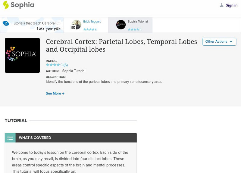 Sophia: Cerebral Cortex: Parietal Lobes, Temporal Lobes and Occipital Lobes Handout
