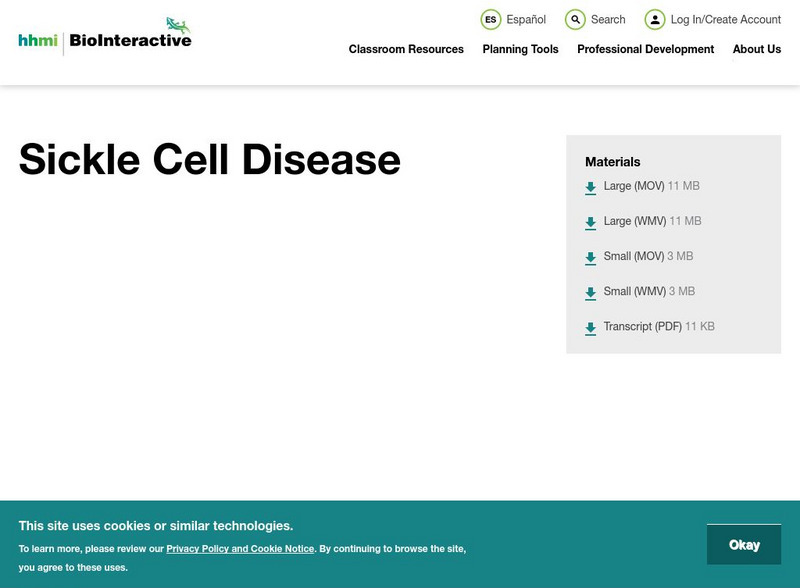 Hhmi: Biointeractive: Dna: Sickle Cell Anemia Instructional Video Hhmi: Biointeractive: Dna: Sickle Cell Anemia Instructional Video