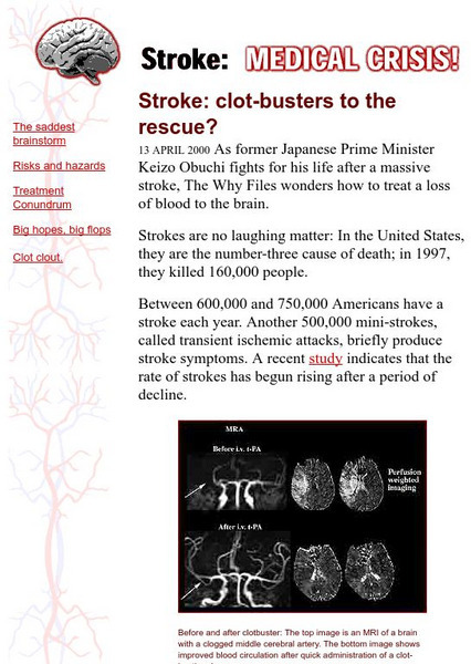 The Why Files: Stroke. Medical Crisis Handout The Why Files: Stroke. Medical Crisis Handout