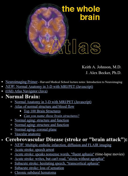 Harvard Medicine: The Whole Brain Handout Harvard Medicine: The Whole Brain Handout