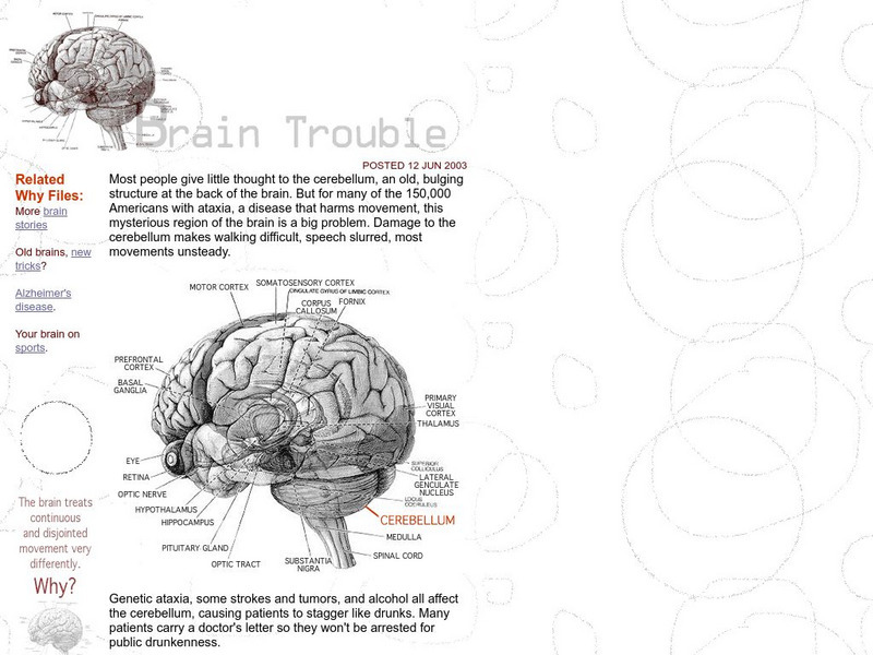 The Why Files: Brain Trouble Handout The Why Files: Brain Trouble Handout