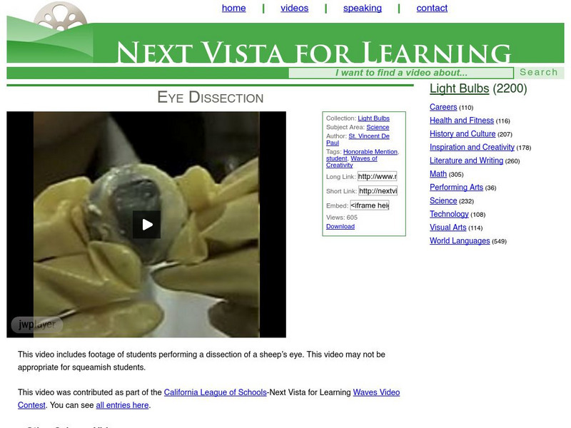 Next Vista for Learning: Eye Dissection Instructional Video Next Vista for Learning: Eye Dissection Instructional Video