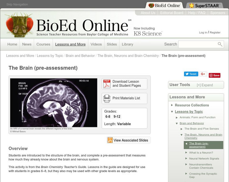 Bio Ed Online: The Brain: Pre Assessment Unknown Type Bio Ed Online: The Brain: Pre Assessment Unknown Type