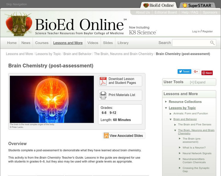 Bio Ed Online: Brain Chemistry Post Assessment Unknown Type Bio Ed Online: Brain Chemistry Post Assessment Unknown Type
