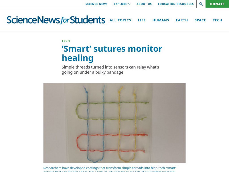 Science News for Students: 'Smart' Sutures Monitor Healing Article Science News for Students: 'Smart' Sutures Monitor Healing Article