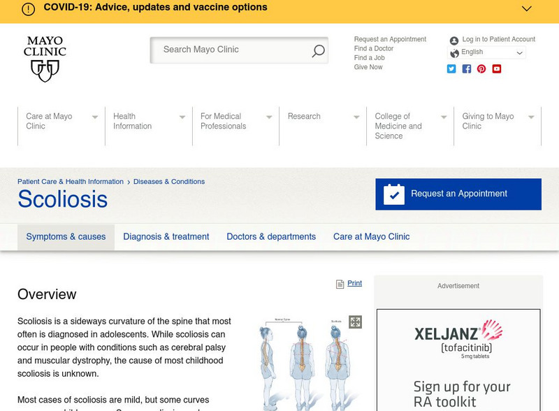 Mayo Clinic: Scoliosis Website