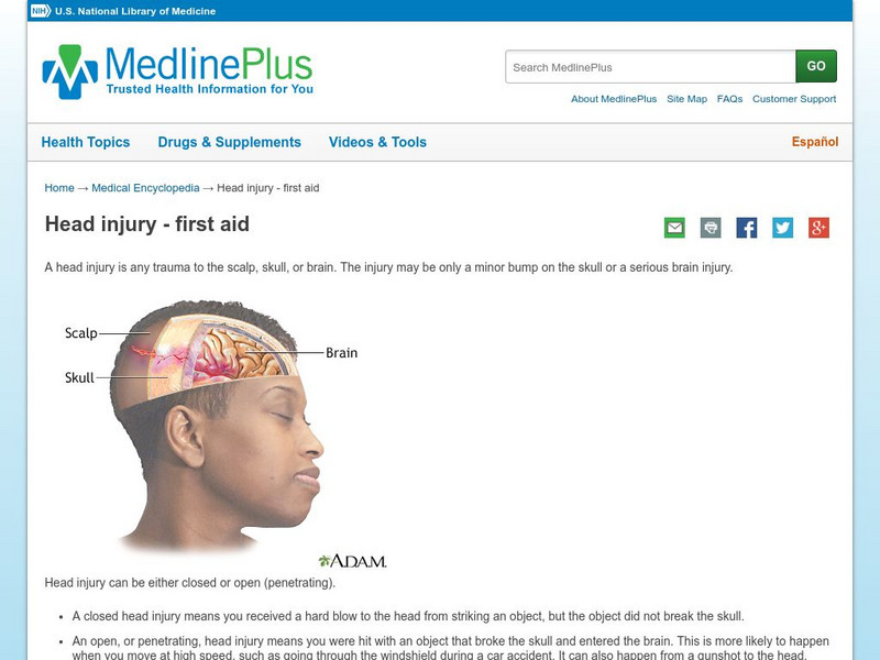 Medline Plus: Head Injury Handout Medline Plus: Head Injury Handout