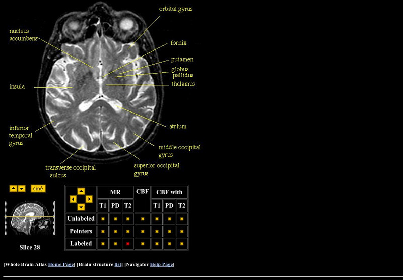 Harvard Medical School: Thalamus Graphic