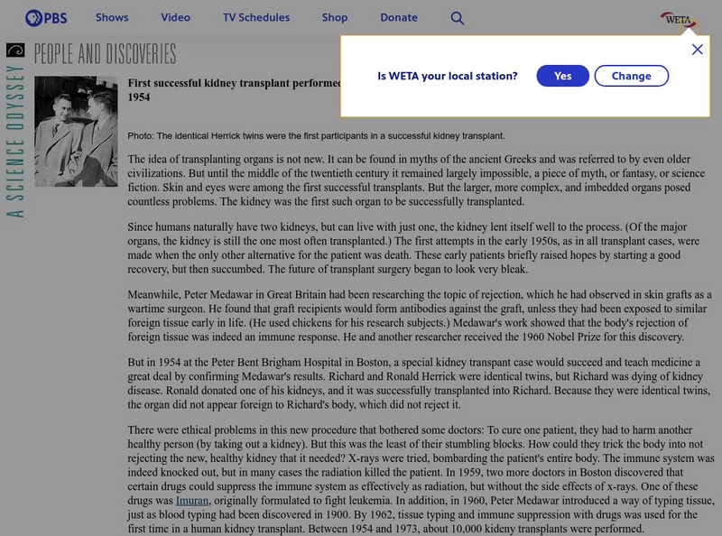 Pbs: First Successful Kidney Transplant Performed Handout Pbs: First Successful Kidney Transplant Performed Handout