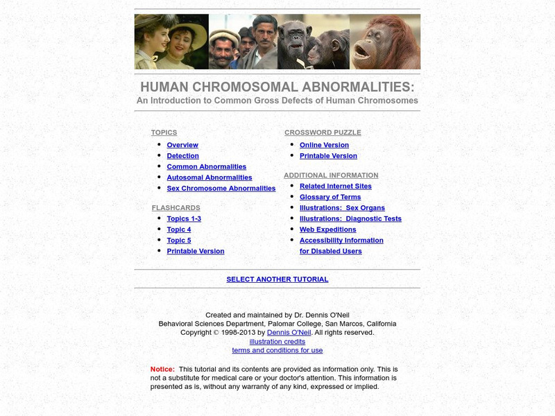 Human Chromosomal Abnormalities (Tutorial) Handout Human Chromosomal Abnormalities (Tutorial) Handout