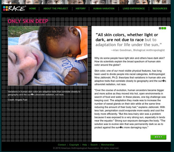 Understanding Race: Only Skin Deep Handout Understanding Race: Only Skin Deep Handout