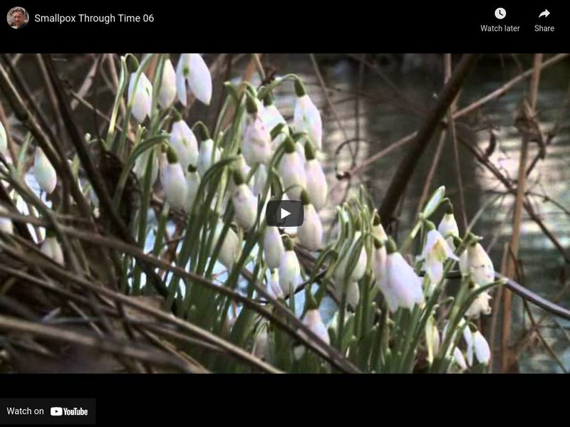Timelines Tv: Smallpox Through Time 06: The Speckled Monster Instructional Video