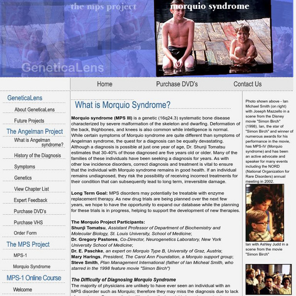 Genetica Lens: Morquio Syndrome Handout Genetica Lens: Morquio Syndrome Handout