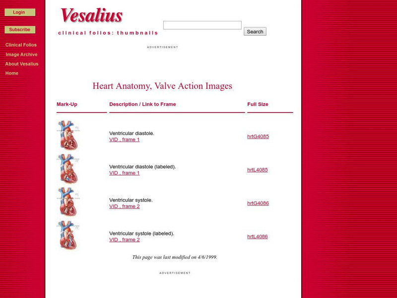Vesalius: Heart Anatomy, Valve Action Graphic Vesalius: Heart Anatomy, Valve Action Graphic