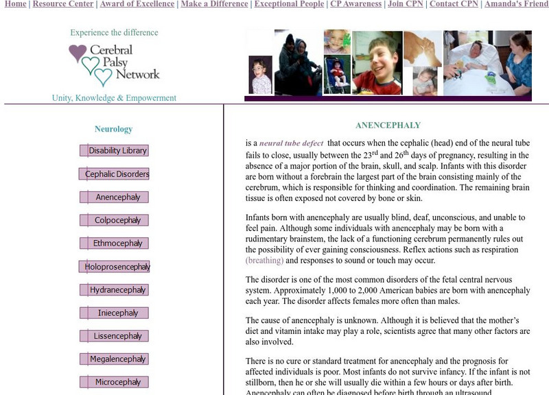 The Cerebral Palsy Network: Anencephaly Handout
